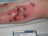 Cuando el jardinero
                        bajo el pozo para salvar el perro, el perro solo
                        pens� mal y mordi� al jardinero...