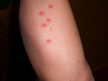 ... mordió mucho a un hombre
... ... mordió mucho a un
hombre ...