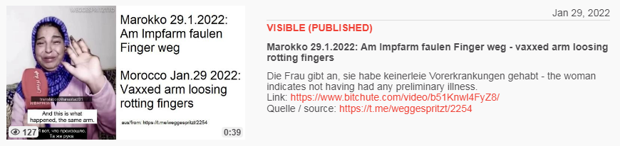 Video vom 29.1.2022: Marokko 29.1.2022: Am
Impfarm faulen Finger weg - vaxxed arm loosing rotting
fingers Video vom 29.1.2022: Marokko 29.1.2022:
Am Impfarm faulen Finger weg - vaxxed arm loosing
rotting fingers