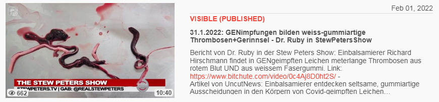 Video vom 1.2.2022: 31.1.2022: GENimpfungen
bilden weiss-gummiartige Thrombosen+Gerinnsel - Dr.
Ruby in StewPetersShow Video vom 1.2.2022:
31.1.2022: GENimpfungen bilden weiss-gummiartige
Thrombosen+Gerinnsel - Dr. Ruby in StewPetersShow