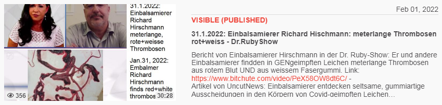 Video vom 1.2.2022: 31.1.2022: Einbalsamierer
Richard Hischmann: meterlange Thrombosen rot+weiss -
Dr.RubyShow Video vom 1.2.2022: 31.1.2022:
Einbalsamierer Richard Hischmann: meterlange
Thrombosen rot+weiss - Dr.RubyShow