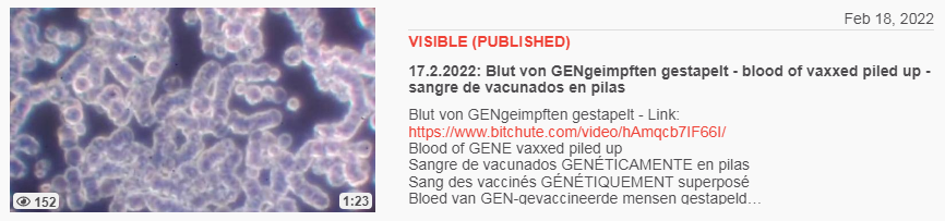 Video vom 18.2.2022: 17.2.2022: Blut von
GENgeimpften gestapelt - blood of vaxxed piled up -
sangre de vacunados en pilas Video vom
18.2.2022: 17.2.2022: Blut von GENgeimpften gestapelt
- blood of vaxxed piled up - sangre de vacunados en
pilas