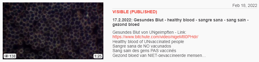 Video vom 18.2.2022: 17.2.2022: Gesundes Blut -
healthy blood - sangre sana - sang sain - gezond
bloed Video vom 18.2.2022: 17.2.2022: Gesundes
Blut - healthy blood - sangre sana - sang sain -
gezond bloed